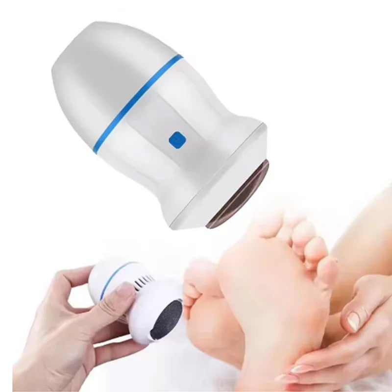 Back Callus Remover with Built-In Vacuum ? Electric Foot Grinder for Dead Skin, Cracked Heels &amp; Calluses, Rechargeable Pedicure Tool with Gentle &amp; Powerful Exfoliation