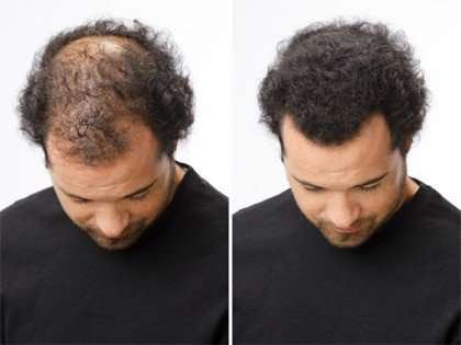 Toppik Hair Building Fiber | Pack of 3 Toppik Hair Fiber ( 27.5g ) + Applicator + Comb - Image 3
