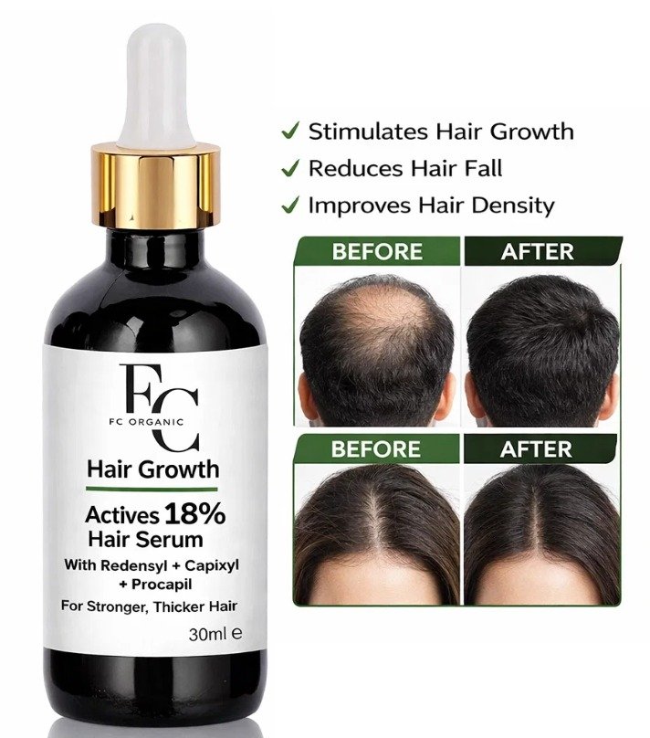 Herbal Hair Growth Serum 30ml | Rosemary & Onion Water-Based Formula - Image 2