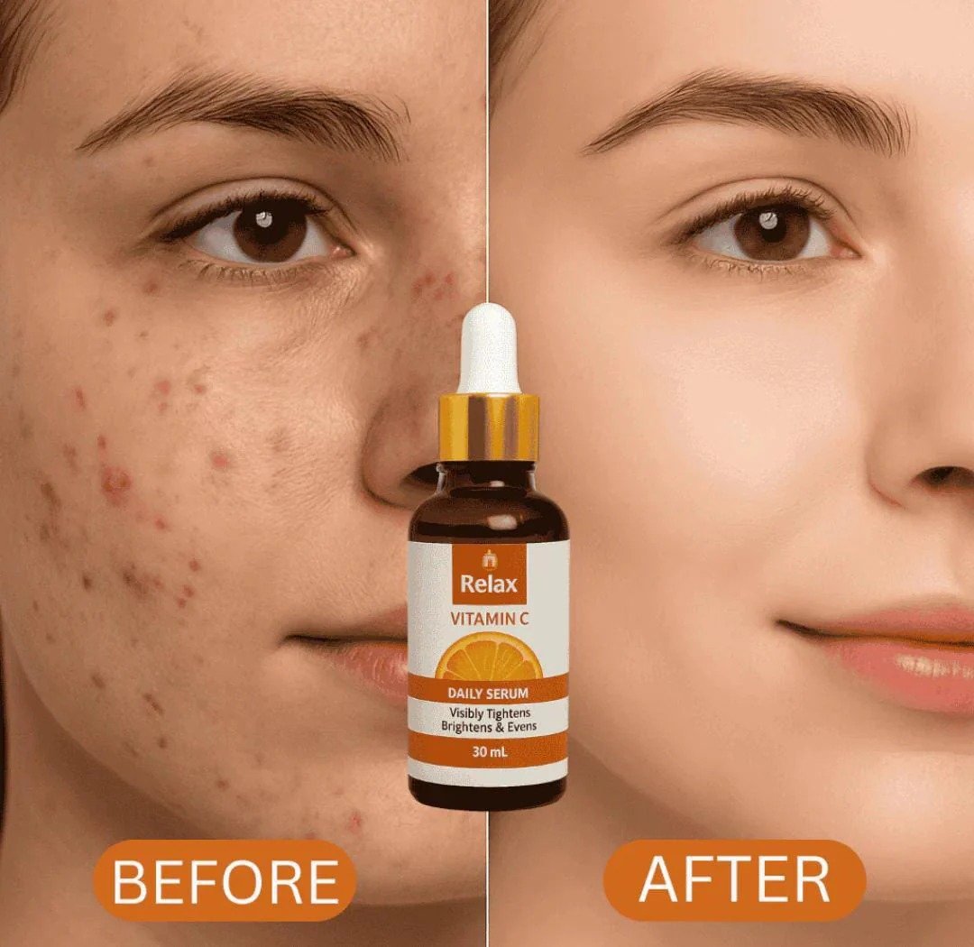 Relax Vitamin C Daily Face Serum – Brightening, Anti-Aging & Hydrating Formula For Healthy Radiant Skin (30ml) - Image 2