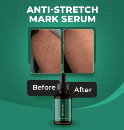 Markaway Stretch Mark Serum – Herbal Formula For Hydration, Toning & Dark Spot Correction (30ml) - Image 3