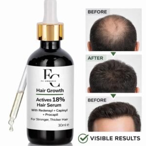 Herbal Hair Growth Serum 30ml | Rosemary & Onion Water-Based Formula