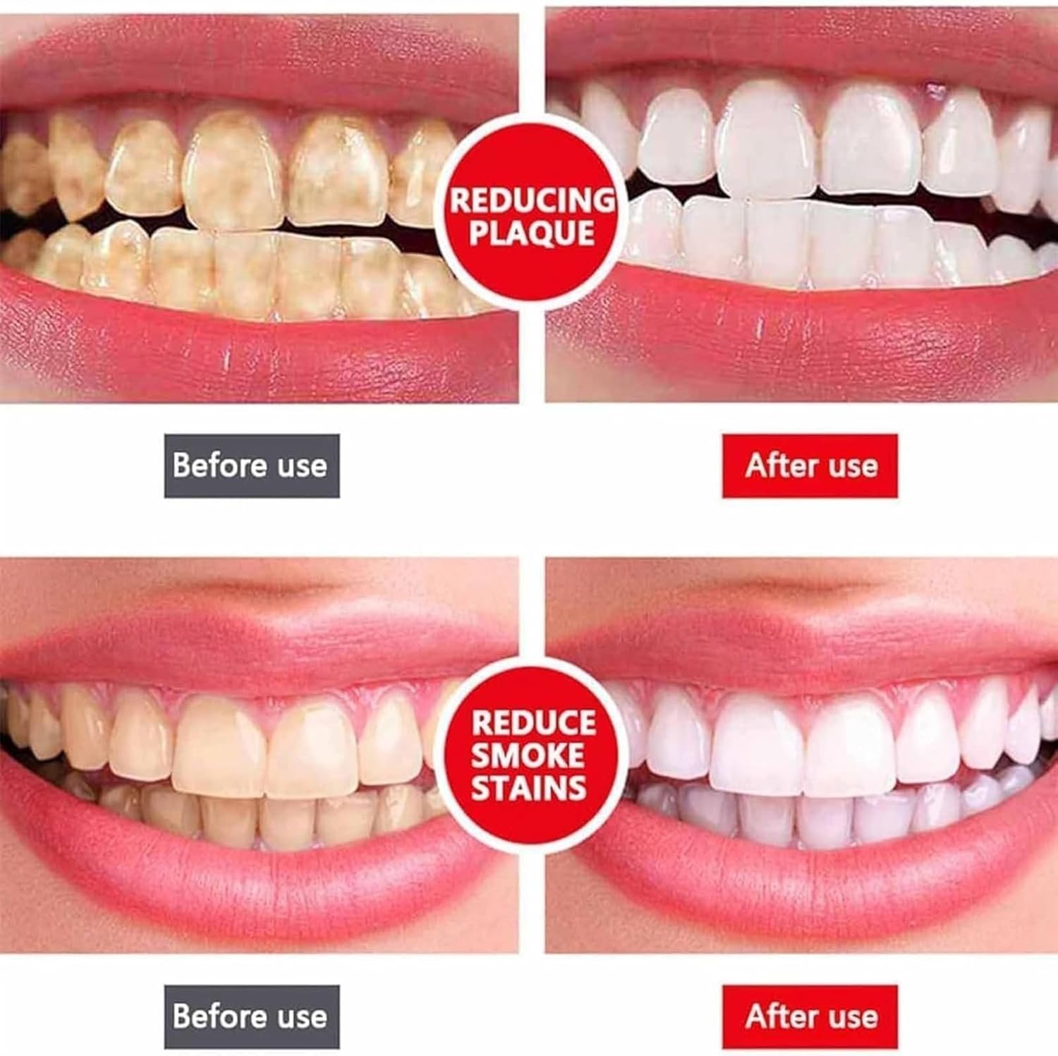 Yayashi Sp-4 Ultra Whitening Toothpaste Probiotic Stain Remover 100ml / Stain Removing Toothpaste, Protects Gums Freshens Breath, for Everyone - Image 3