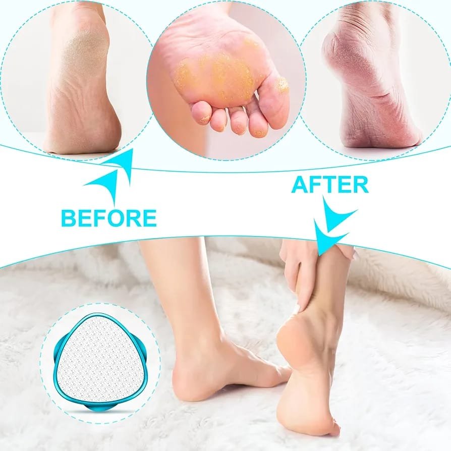 2 in 1 Double-Sided Nano Glass Callus Remover & Crystal Hair Eraser – Safe & Quick Foot File, Dead Skin & Hard Callus Remover, Painless Epilator for Women, Portable Pedicure Tool (Random Color) - Image 2