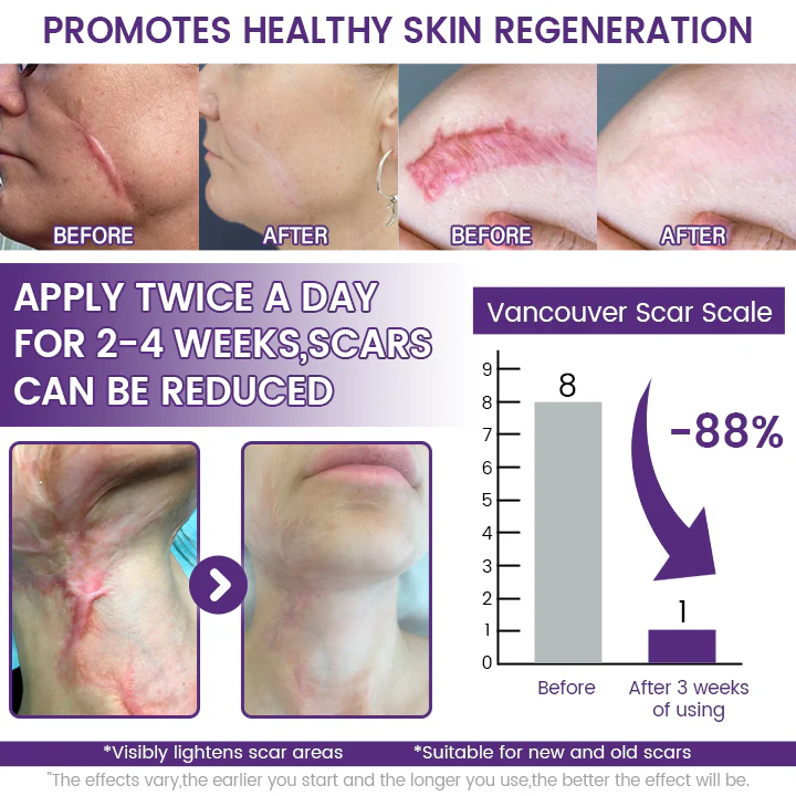 Timilk Regenscar Stem Cell Scar Gel 20g Triple Action Formula For Old And New Scars Surgical Marks Skin Renewal - Image 2